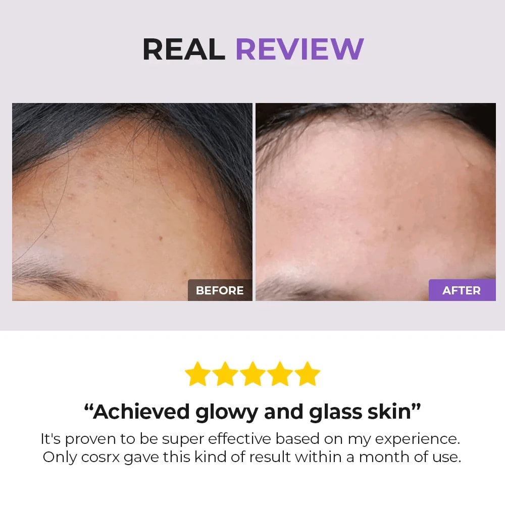 Cosrx AHA/BHA Clarifying Treatment Toner