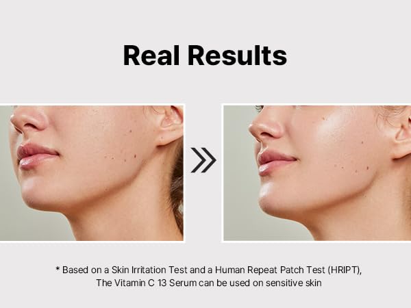 Cosrx The Vitamin C 13 Serum