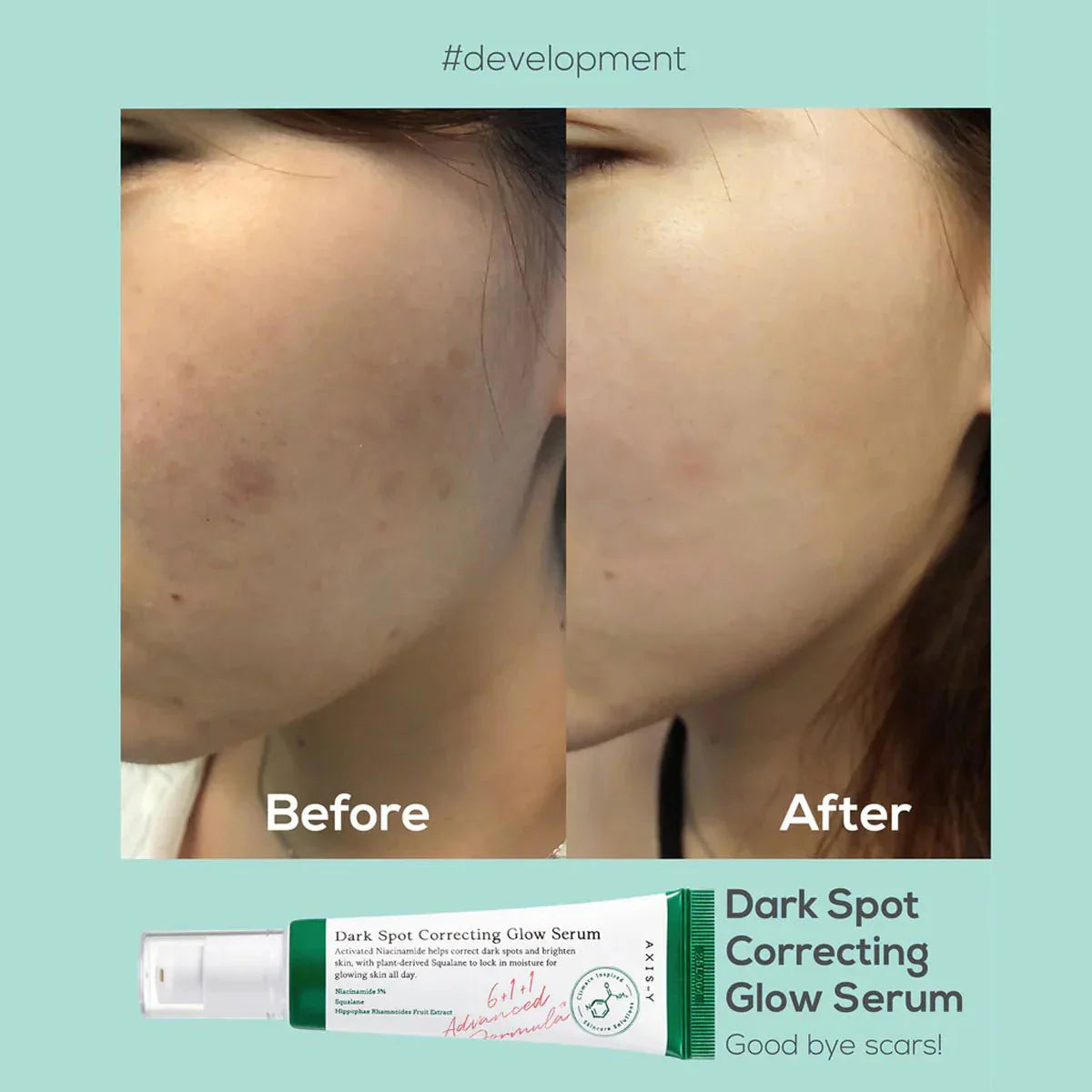 Dark Spot Correcting Glow Serum