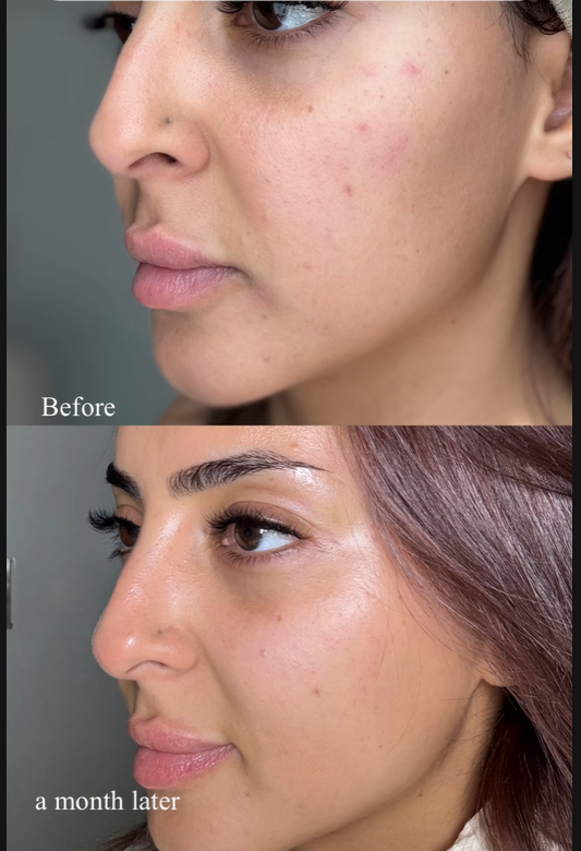 Retinal Shot Tightening Booster 15ml