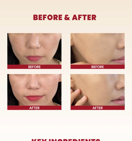 SEOUL 1988 Cream : Snail Mucin 93% + Rice