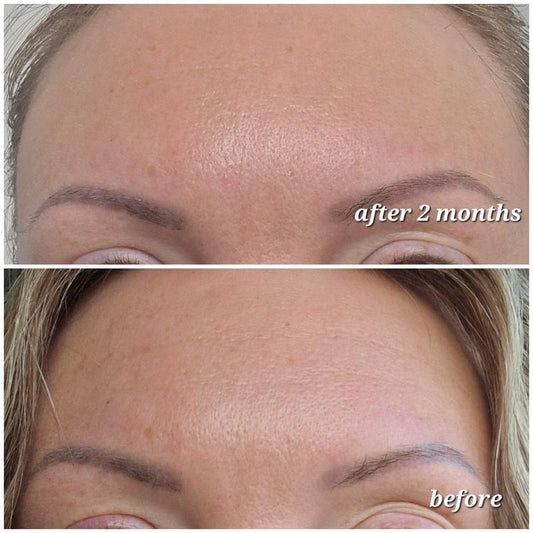 The Ordinary Argireline solution 10% (BOTOX serum)