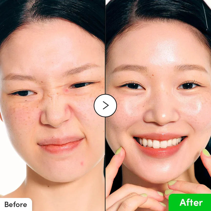 Eqqualberry Aloe PDRN Calming Serum