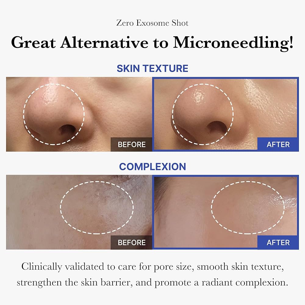 Medicube Zero Exosome Shot 2000 PPM