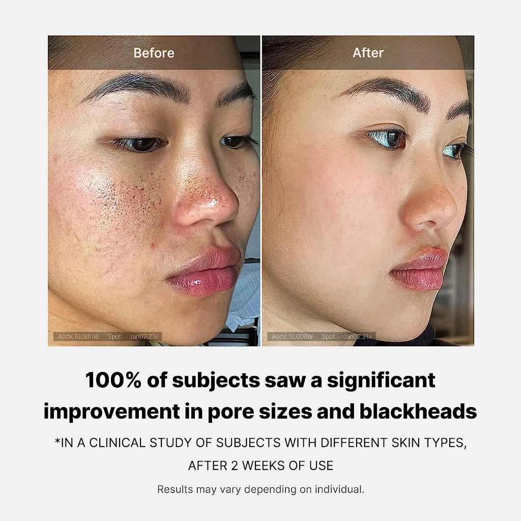 Medicube Zero Pore Pad