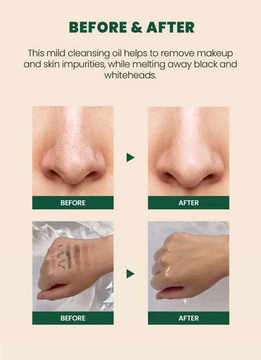 SEOUL 1988 Cleansing Oil : Pine Cica 1% + Probiotics