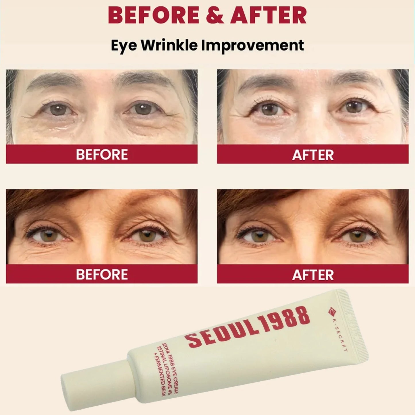 Seoul 1988 Eye Cream : Retinal Liposome 4% + Fermented Bean