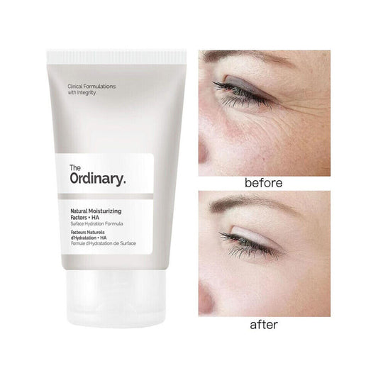 The Ordinary Natural Moisturizing Factors + HA