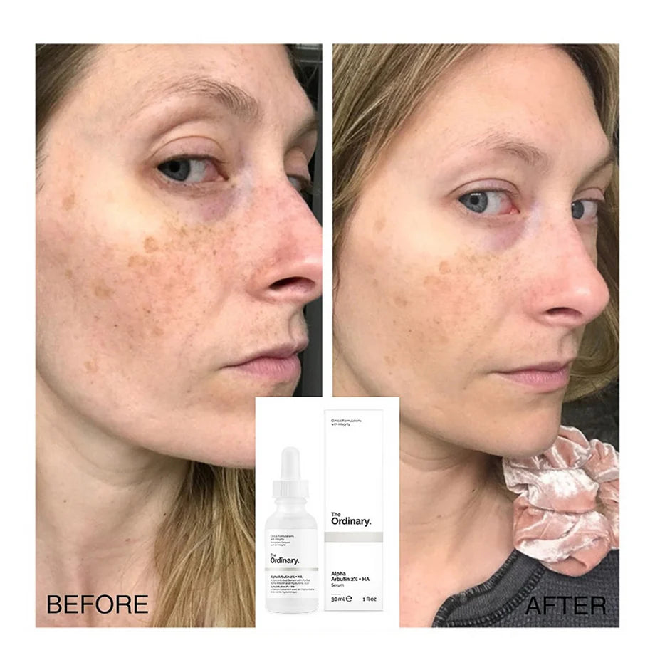 The Ordinary Alpha Arbutin 2% + Ha Hyperpigmentation Serum