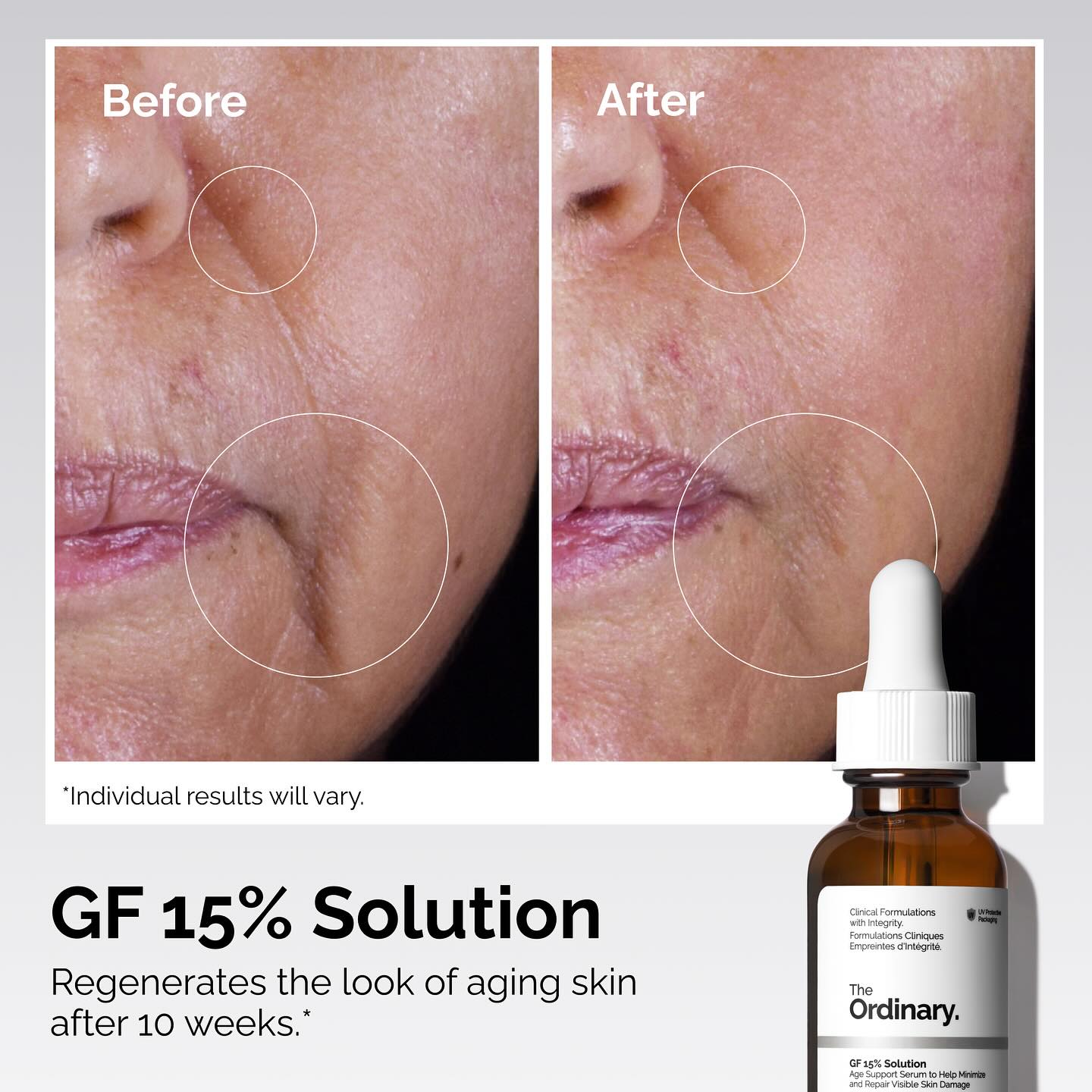 The Ordinary GF 15% solution